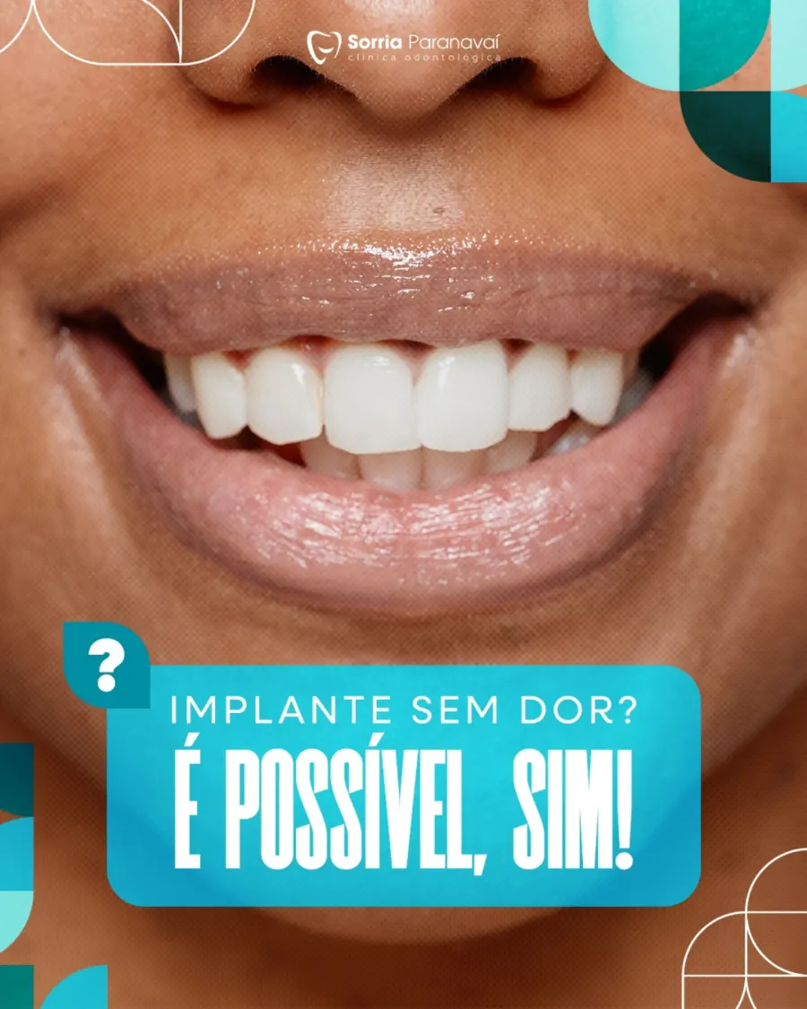 Close de sorriso com a pergunta Implante sem dor? É possível, sim!