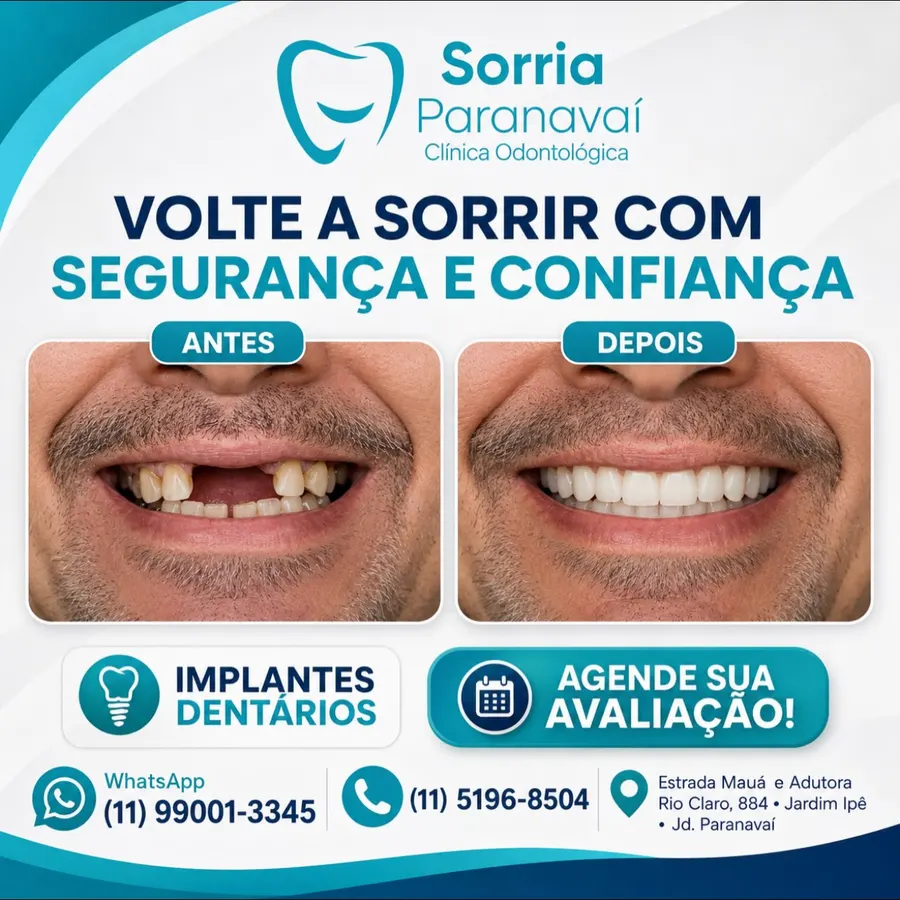 Antes e depois de paciente com implantes dentários na Sorria Paranavaí