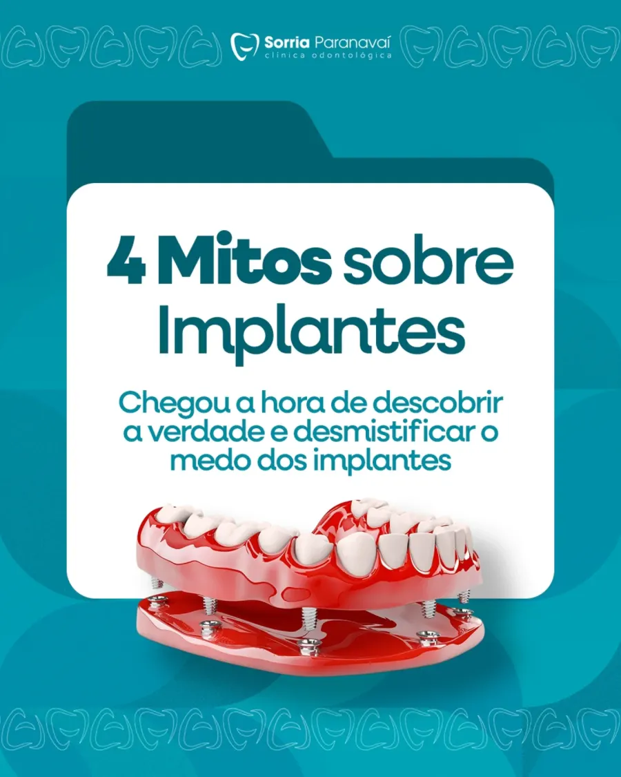 Carrossel educativo: 4 mitos sobre implantes, com modelo de prótese sobre implantes